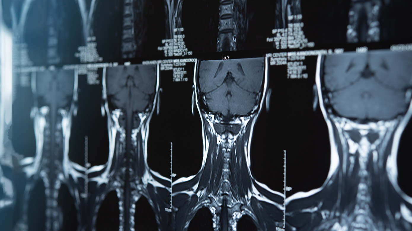 X-ray of brain and spinal cord